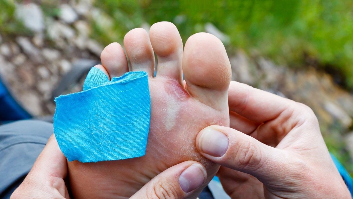 How to Prevent Blisters When Hiking and Backpacking | Cloudline Apparel